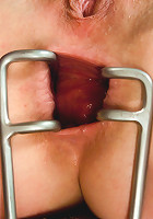 Stretching and Fisting Proxy