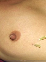 Abused nipple