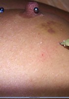 Abused nipple