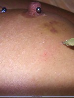 Abused nipple