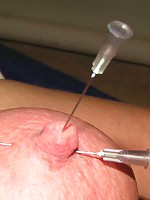 Private Needle Pain