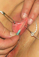 Needles in Clitoris