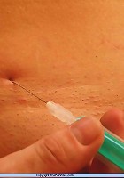 Amateur Needle Pain
