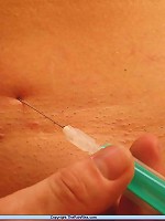 Amateur Needle Pain