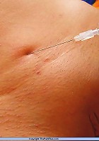 Amateur Needle Pain