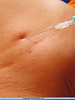 Amateur Needle Pain