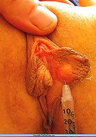 Amateur Needle Pain