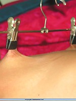 Needles in Tits and Feet