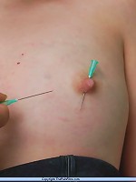 Outdoor Needle Pain